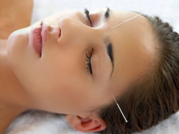Acupuncture can help you